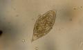 oeuf-de-schistosomiase-haema-2001.jpg